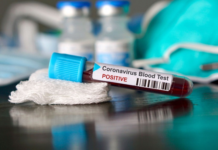 18 смертей та 367 інфікованих коронавірусом зафіксували на Тернопільщині