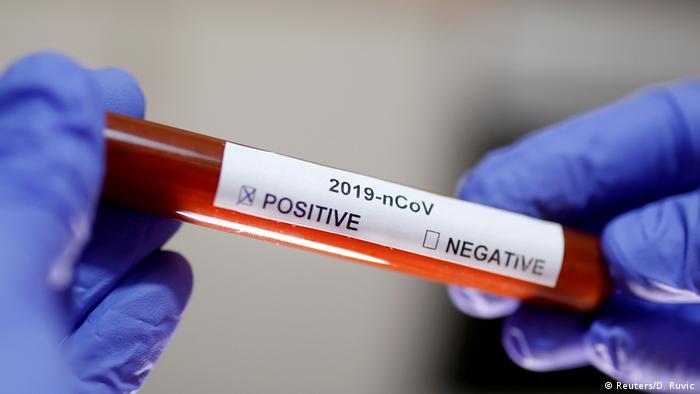 25 тисяч випадків коронавірусу зафіксували в Україні: близько 900 людей з Тернопільщини