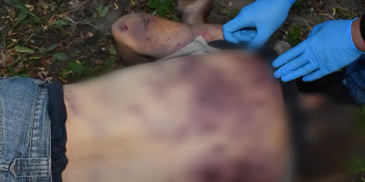 До смерті побив односельця: на Тернопільщині чоловік вирішив провчити злодія різками