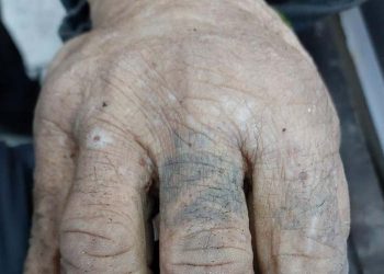 Просять допомогти встановити особу чоловіка, якого смертельно травмував автомобіль на Тернопільщині