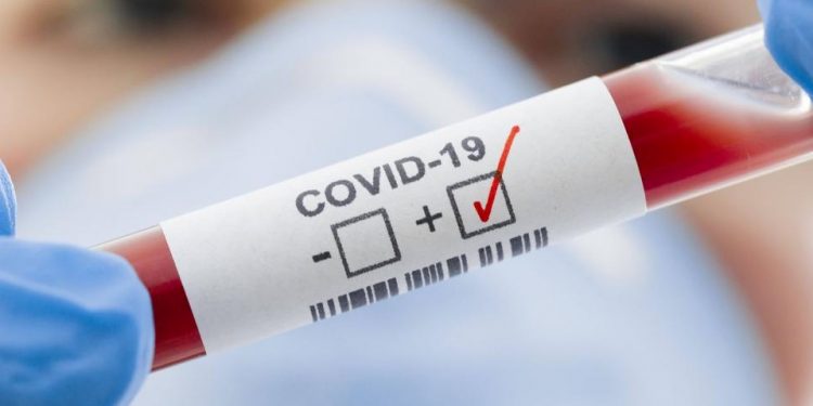 Новий штам ковіду “Кракен” вперше зафіксували в Україні