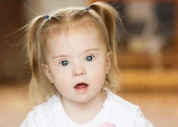 День людей із синдромом Дауна відзначають у світі 21 березня