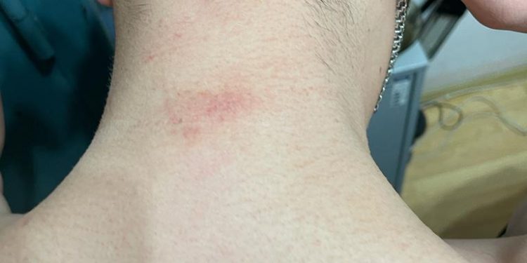 Судитимуть тернопільських правоохоронців, які побили підозрюваного, аби той зізнався у злочині