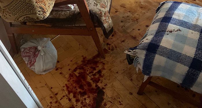 Людей евакуйовували з тернопільської багатоповерхівки, бо дебошир розлив кислоту