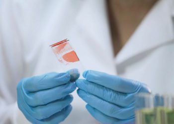 Випадок гепатиту А зафіксували на Тернопіллі