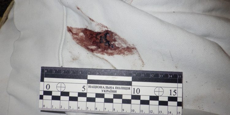 Підлітки жорстоко познущалися з чоловіка з інвалідністю у Тернополі