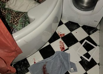 “Ми живі. Малого встигла сховати”, – харківська волонтерка постраждала під час ракетного обстрілу