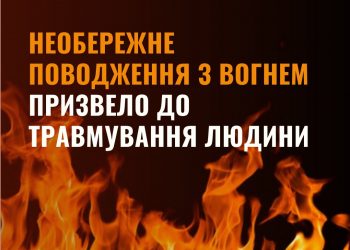 Жителька села Застав’є отримала опіки під час запалювання котла. Зараз знаходиться в лікарні